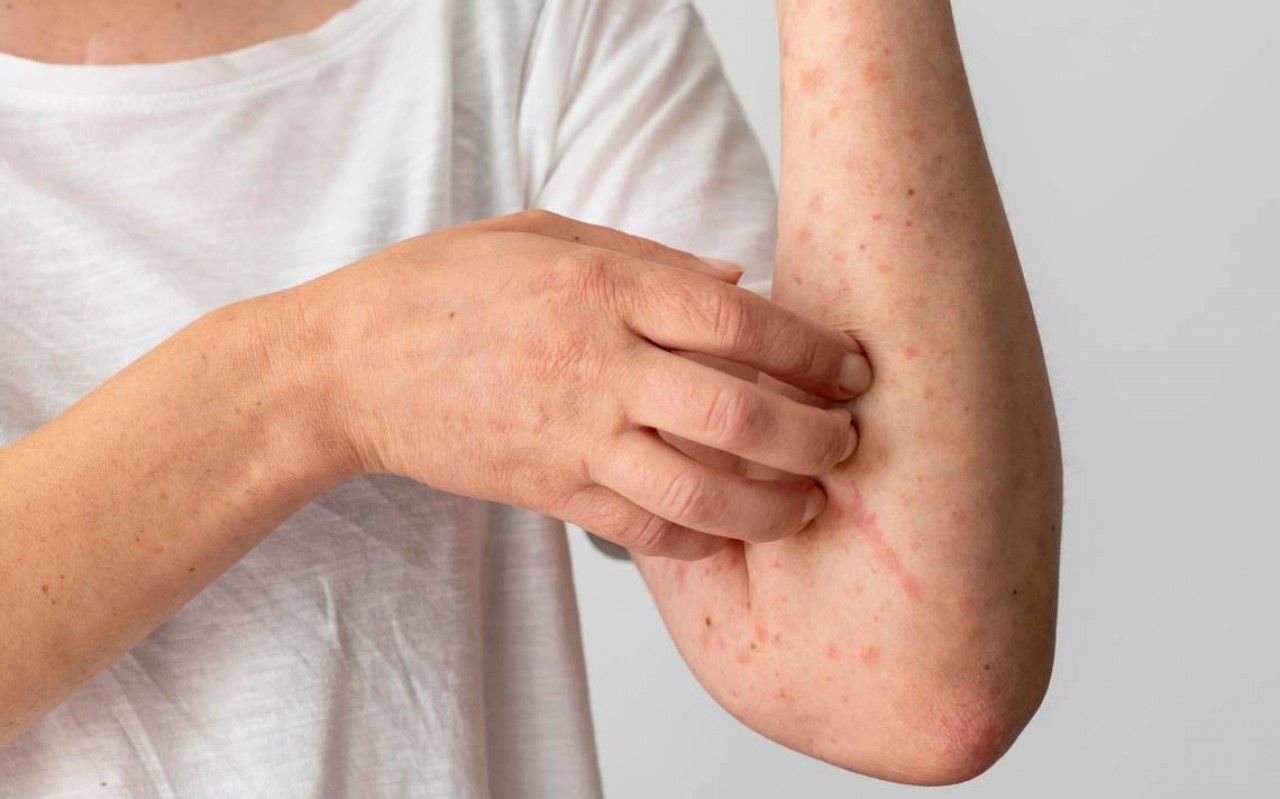 First slide